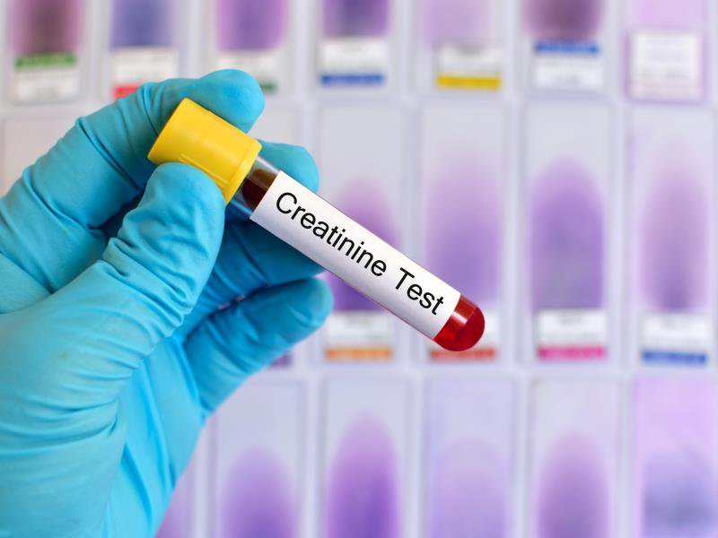 Sinh hóa creatinin chẩn đoán bệnh gì? và hướng dẫn đọc kết quả